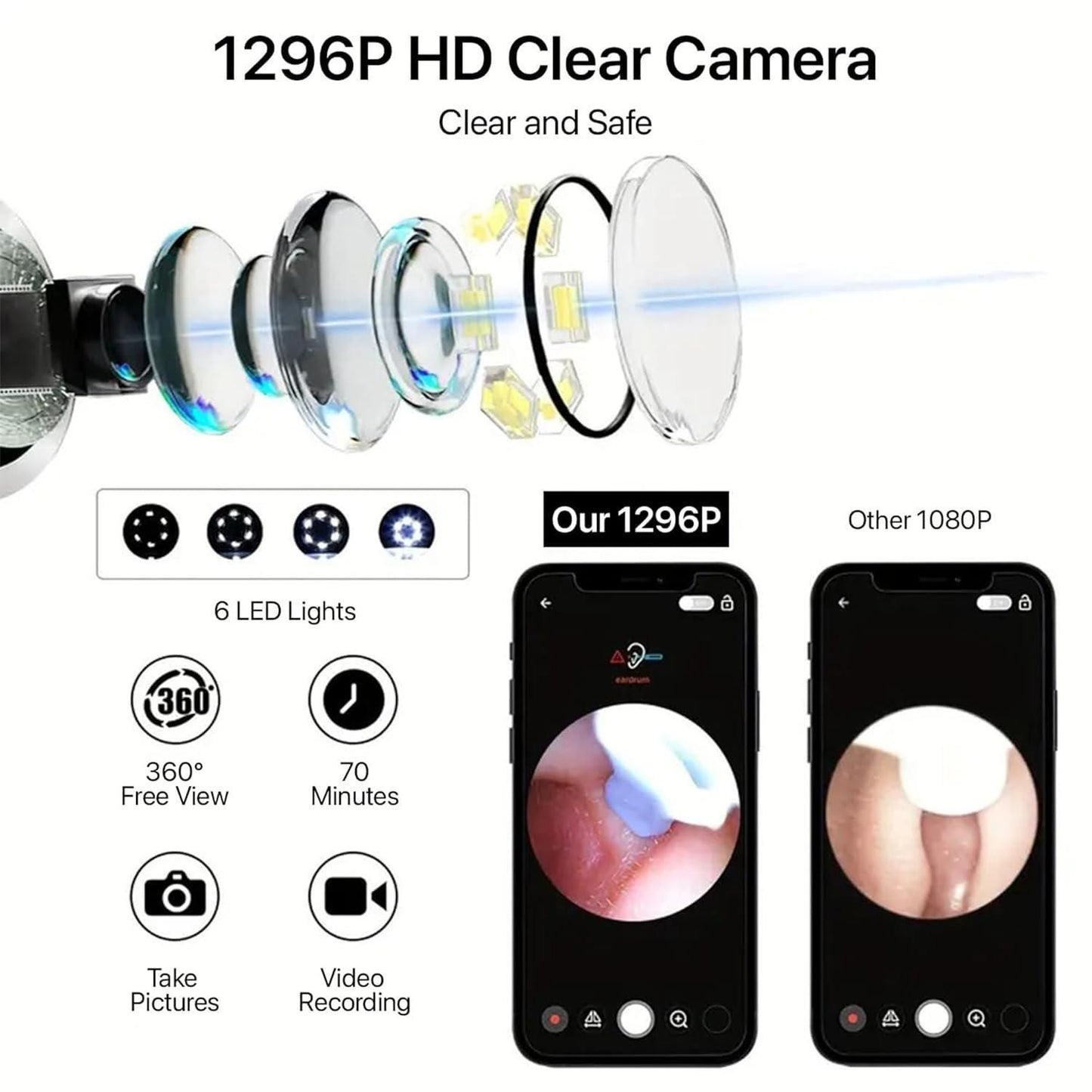 Ear Cleaner Pro – 1080P HD Camera